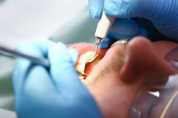 Best Tooth Infection Emergency Dentist  in Mcleansboro, IL