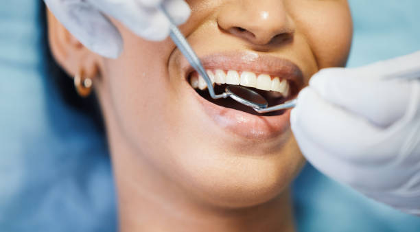 Best Dentist for Tooth Abscess  in Mcleansboro, IL